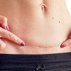Biến chứng sau phẫu và giải pháp Plasma Gold: An toàn, hiệu quả và tiết kiệm