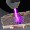 Plasma lạnh trong thẩm mỹ: An toàn hay tiềm ẩn rủi ro?