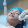 Máy Plasma lạnh không tiêu hao: Giải pháp tối ưu cho phòng khám hiện đại